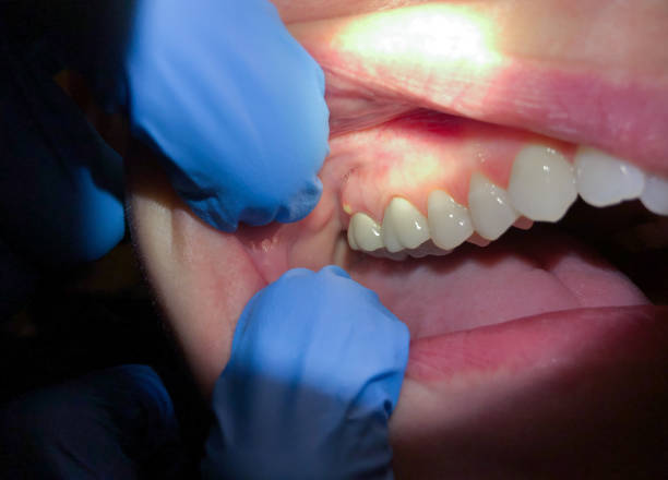 Best Emergency Care for Gum Disease in Green River, WY